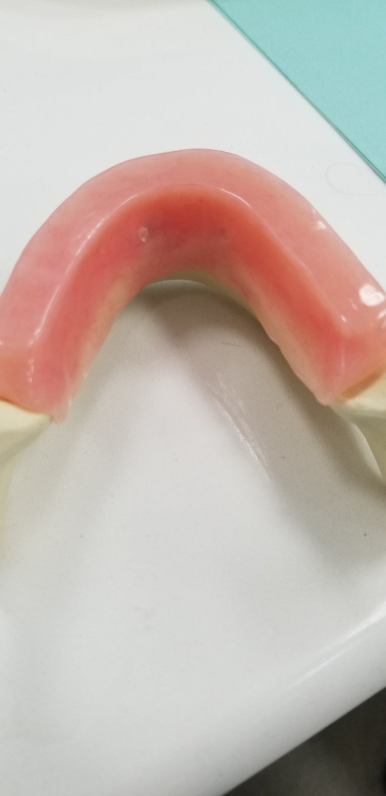 advanced dental overdenture practice model