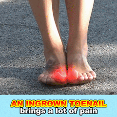 Ingrown Toenail Treatment Remedy Fingernail Care Home Pain Reliever Over The Counter Straightener