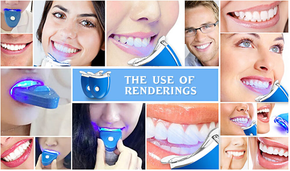 Dental 360 Whitening Kit
