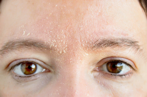 person with hydrated skin