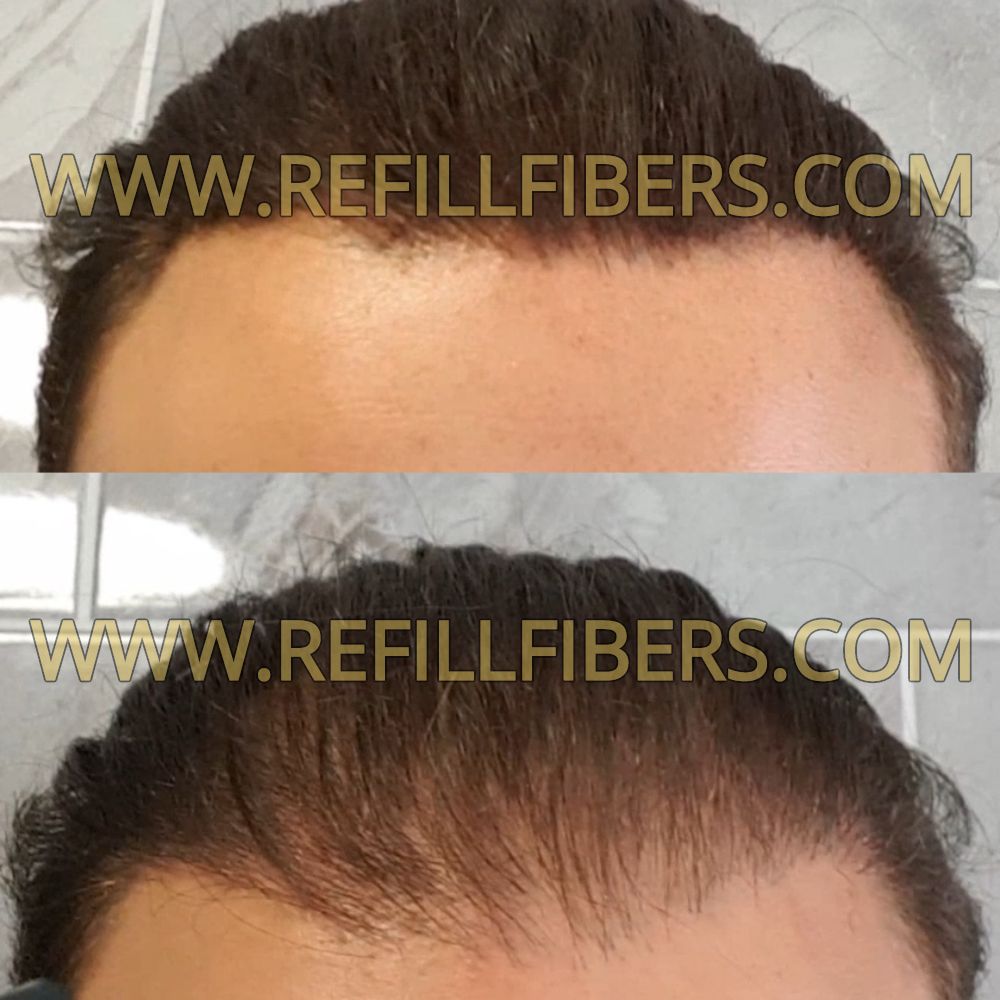 www.RefillFibers.com Hair fiber refill results Before and After
