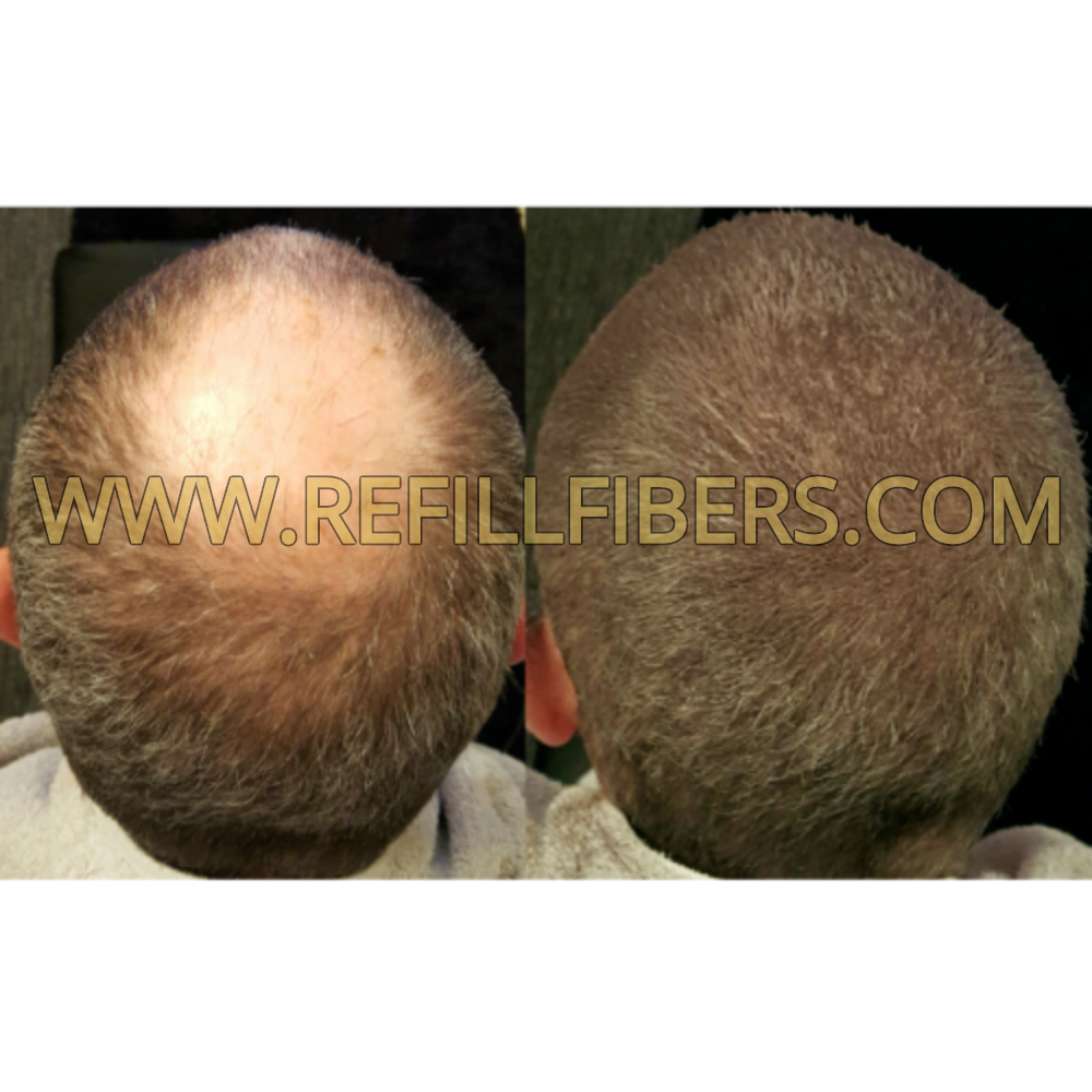 www.RefillFibers.com Hair fiber refill results Before and After 3