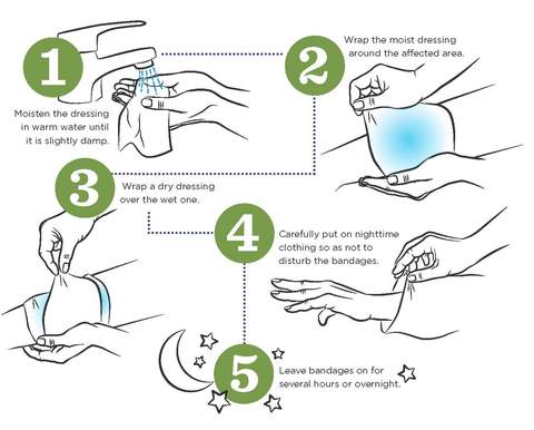baby-woith-eczema-not-sleeping-try-wet-wrap-therapy
