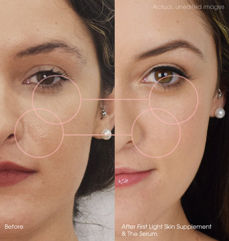 Ellen Before After First Light Duo