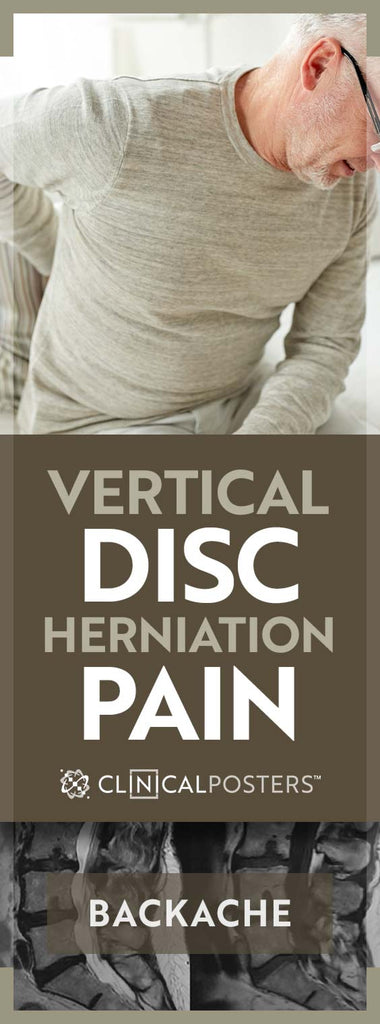 Can Vertical Disc Herniation Cause Pain?